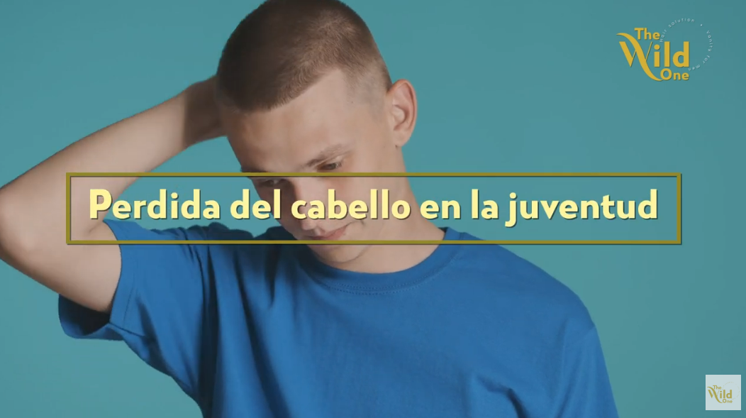 Perdida de cabello a temprana edad The Wild One